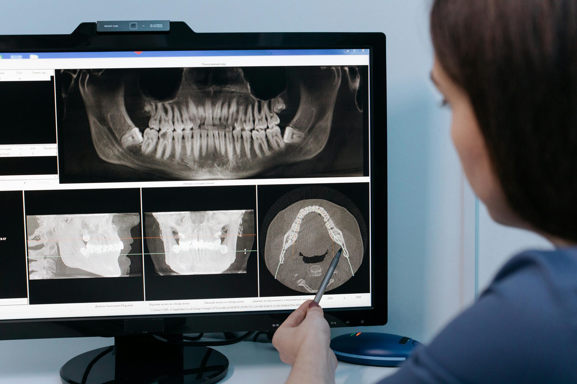Digitale 3D-Diagnostik f&uuml;r Implantatplanung