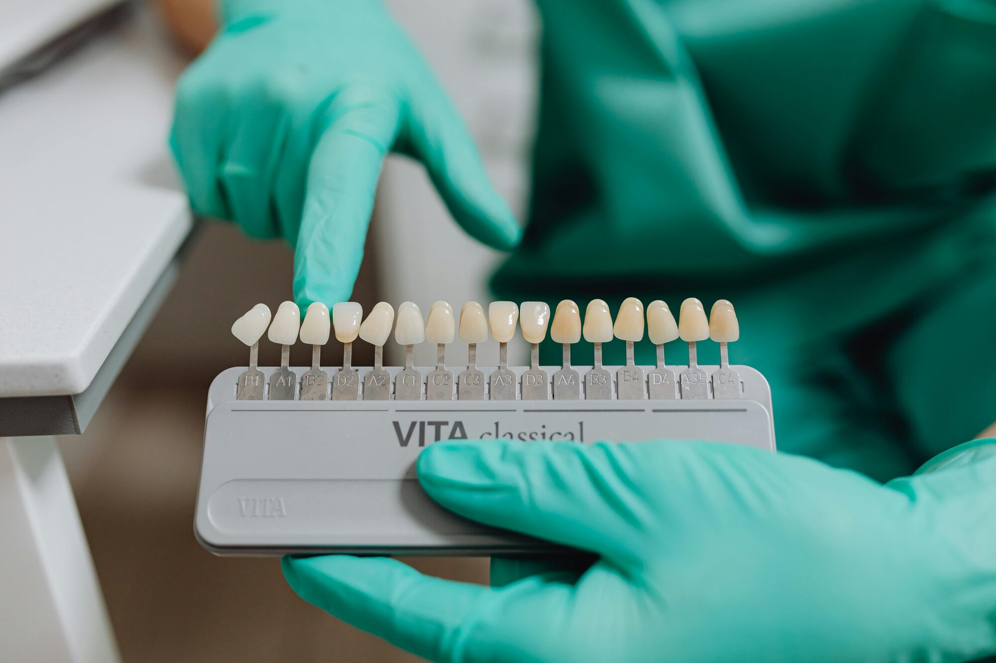 Veneers und &auml;sthetische Zahnkorrekturen